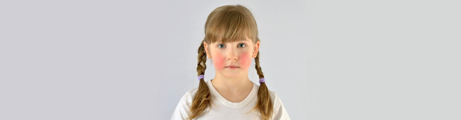 Acne Skin Problems