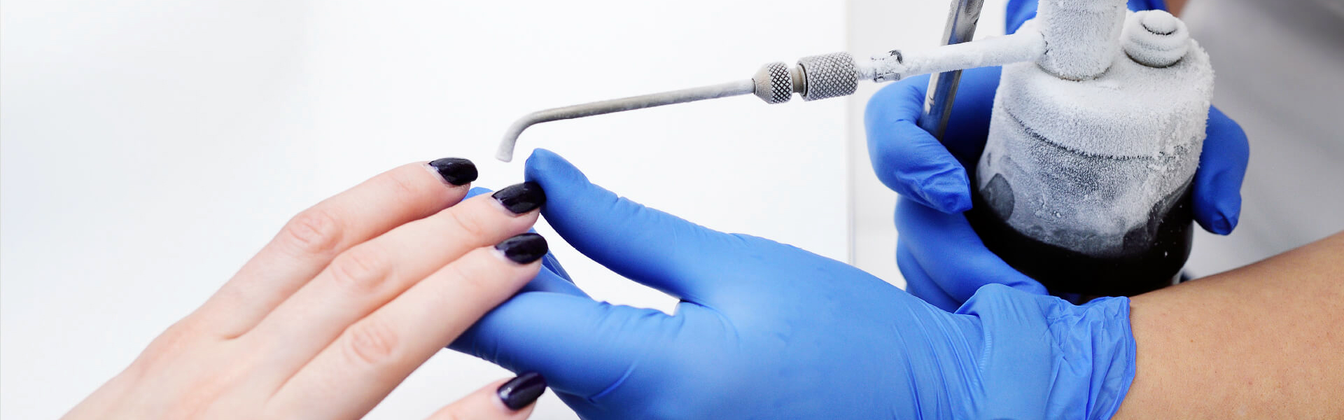Explaining Cryosurgery and Why Is It Performed?